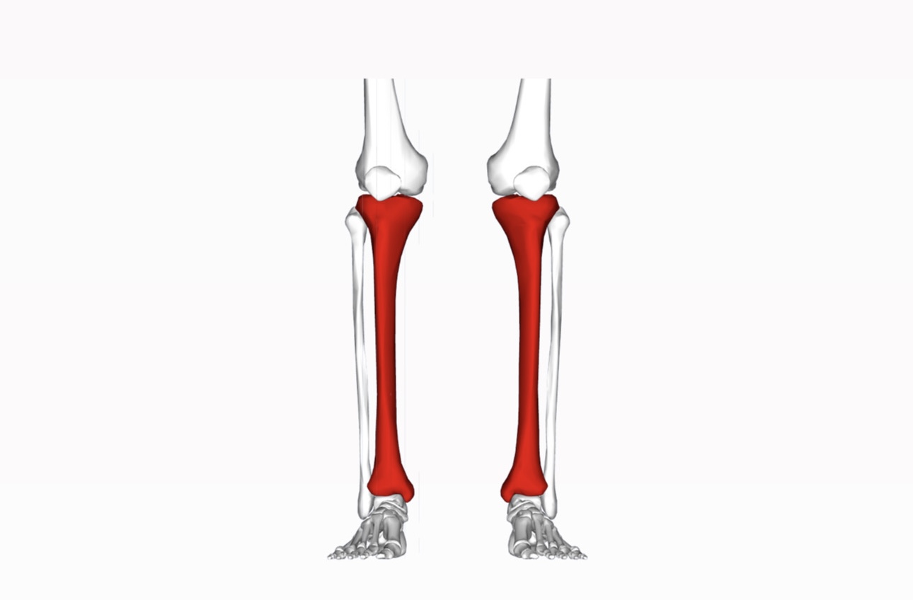 Shin Splints