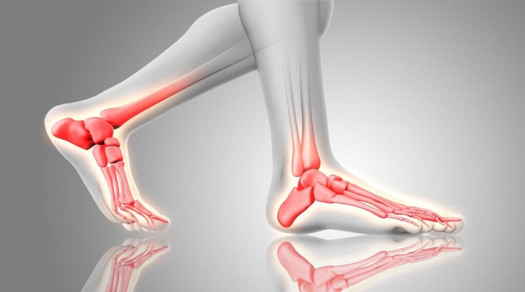 a picture of legs with joints and bones on a plain gray background